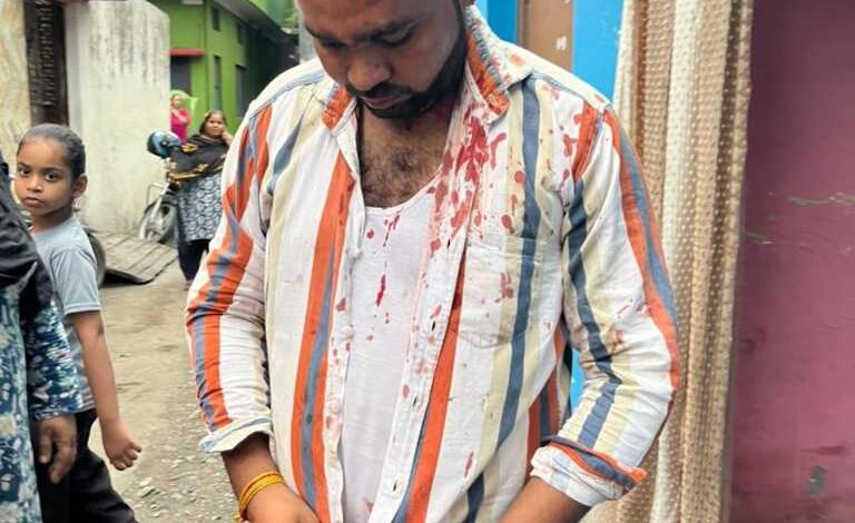 पैसे मांगने पर भाजपा नेता ने फोड़ा चाऊमीन विक्रेता का सिर, मामला दर्ज पैसे मांगने पर भाजपा नेता ने फोड़ा चाऊमीन विक्रेता का सिर, मामला दर्ज