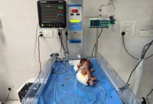 देहरादूनः आधुनिक सुविधाओं से सुसज्जित एसएनसीयू बना नवजातों के लिए संजीवनी