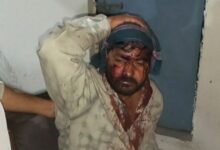 धारदार हथियारों से युवक पर जान लेवा हमला,हालत गंभीर